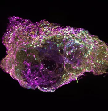 A cross section of a mini bone marrow organoids showing cells that produce blood platelets, in a network of blood vessels. Image credit: Dr A Khan, University of Birmingham